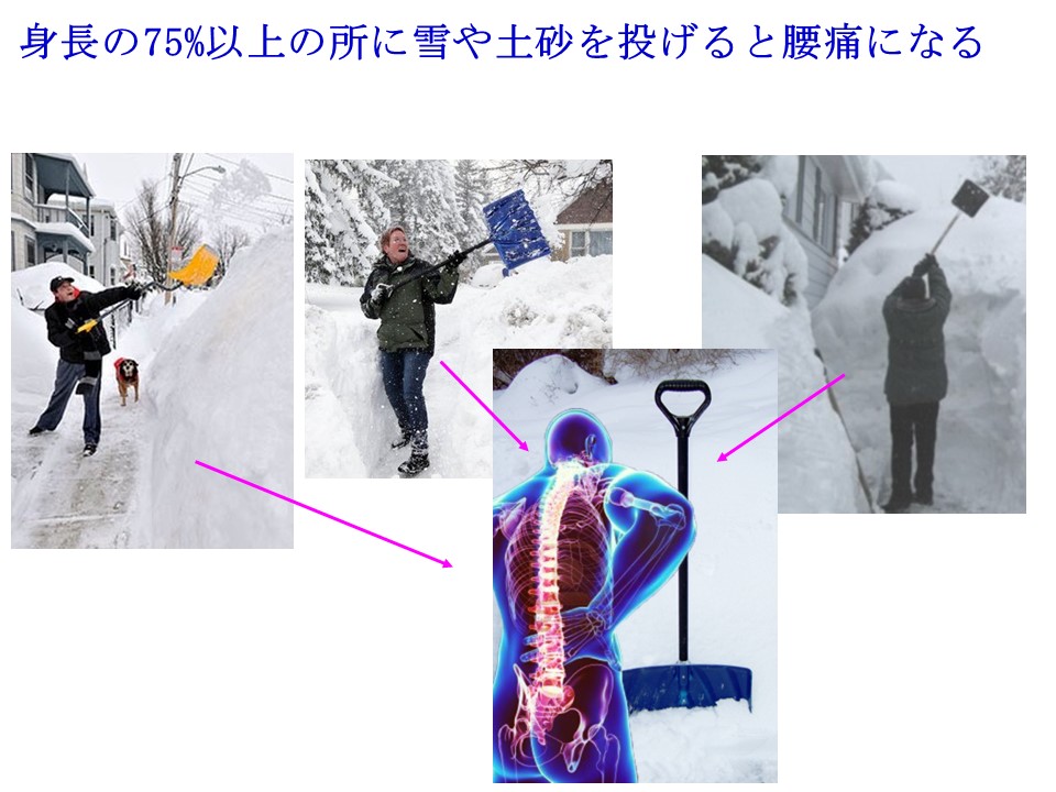雪や土砂を身長の75 以上の高さに放り投げると腰痛が起こる 戸田整形外科リウマチ科クリニック