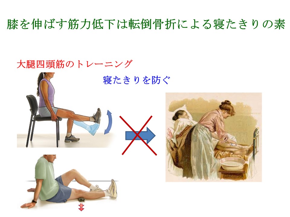 大腿四頭筋の筋力低下は転倒骨折による寝たきりの原因の第２位 戸田整形外科リウマチ科クリニック