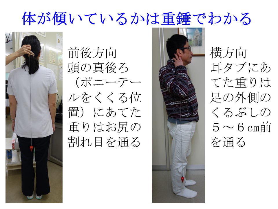 体が傾いていると思うのは くせの問題がほとんどです 戸田整形外科リウマチ科クリニック