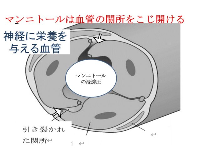 マンニトール 3% リーフレット