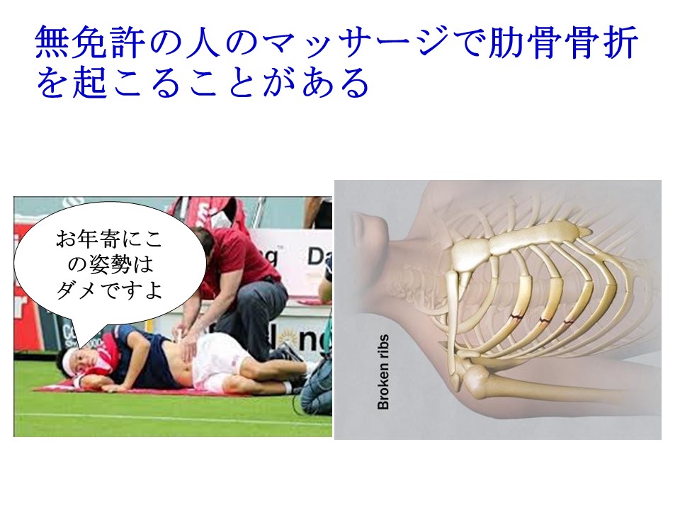 twitter用無免許マッサージで肋骨骨折 - 貴晶会戸田リウマチ科クリニック