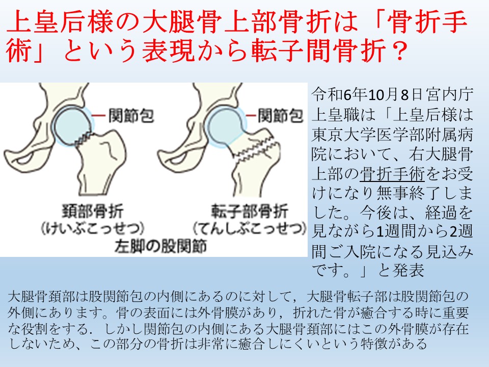 上皇后の大腿骨上部骨折の病状は良好と予測します。