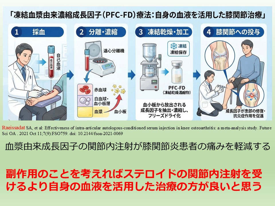 ヒアルロン酸の効きが弱くなったらステロイドより自身の血液を活用した治療の方が良い。