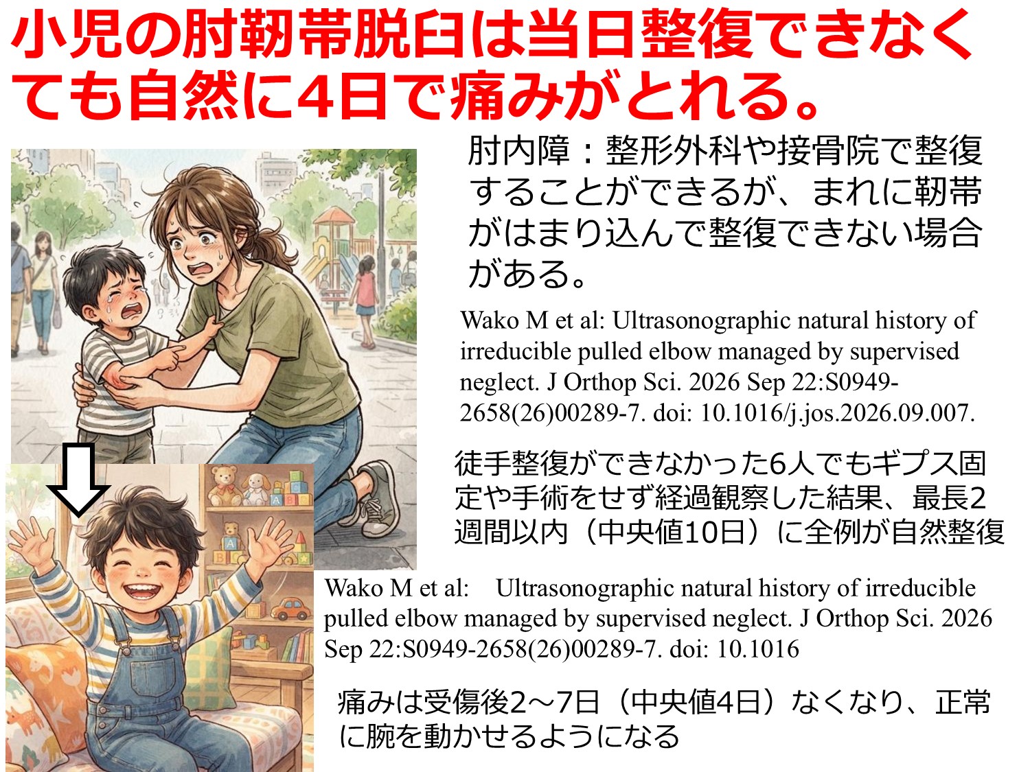 小児の肘靭帯脱臼は当日整復できなくても自然に4日で痛みがとれる。